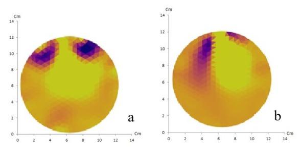 NOSER method with 16 electrodes (a) and 32 electrodes (b) of artificial solid tumor ion shows a match between the reconstructed image and the original object containing two anomalies.