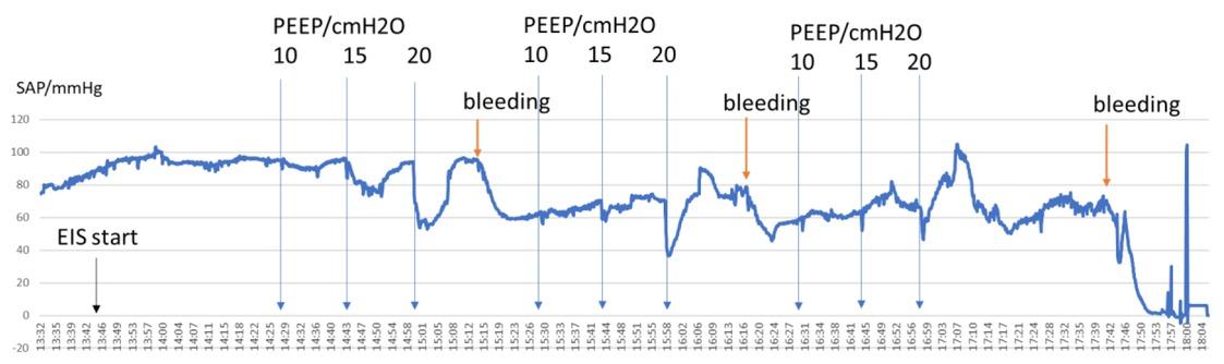 Mean arterial pressure (SAP) during the recoding and challenges (bleeding and PEEP). Y-axis is in mmHg; X-axis is clock time. EIS recording stated at 13.43.