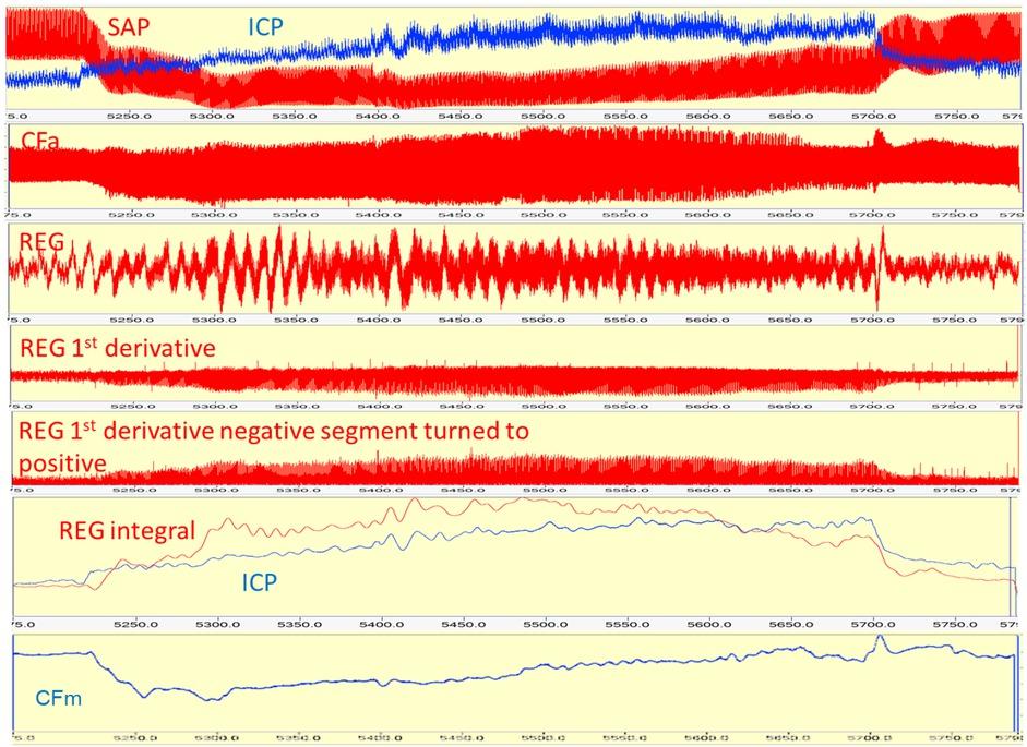 Continuous analog parameters (as a strip chart) vs. time. CBF AR is active.
