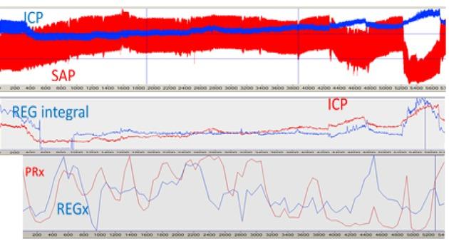 Intracranial pressure (ICP), systemic arterial pressure (SAP), REG integral (REG integral), PRx, and REGx plotted as analog strip chart vs. time. The first number of PRx and REGx calculations starts at 300 sec of the original signal. Pig CBF 9, file 13:32, time window 96.52 min.