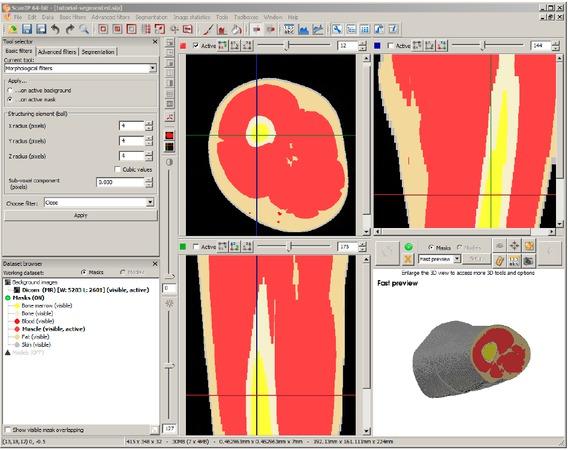 A typical SIP window. In this particular case, after segmentation.