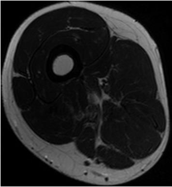 Slice 12 of imported MR data.