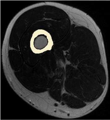 Slice 12 of segmented bone.