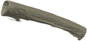 3D-view of segmented bone.