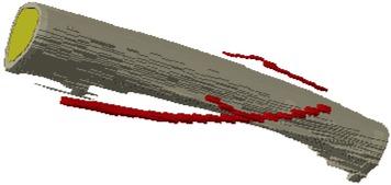 3D-view of bone, bone marrow, and blood.