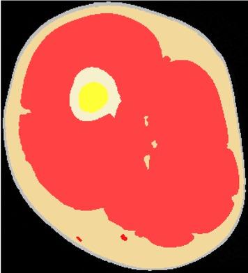 Slice 12 after segmentation.