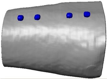 3D-view of thigh with electrodes.