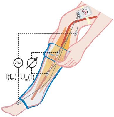 System concept of the semi-capacitive impedance phlebography device.
