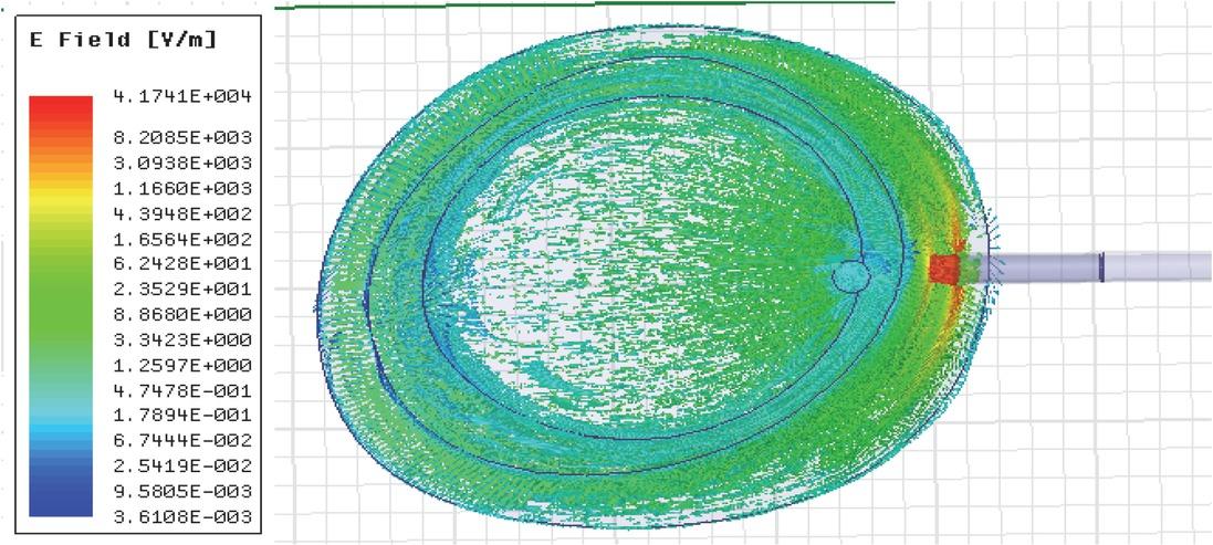 Electric field distribution in the transverse view of the model simulated at 50 kHz for 2.3 mm arterial diameter. The magnitude has been indicated though different color intensities.