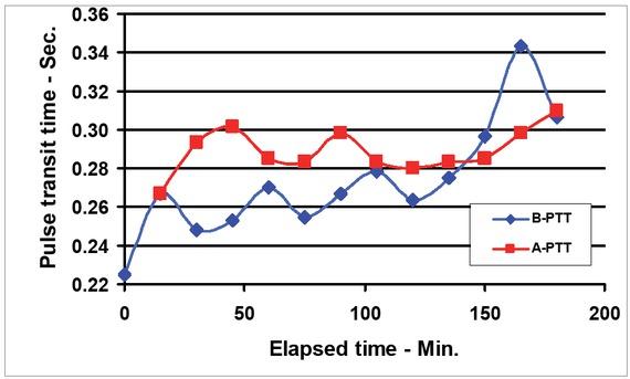 Patient Type A and B’s pulse transit time vs. elapsed time.
