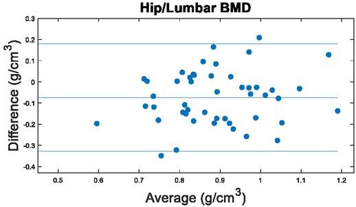 Comparison of Hip and Lumbar Spine DXA BMD. Results by Bland Altman method.