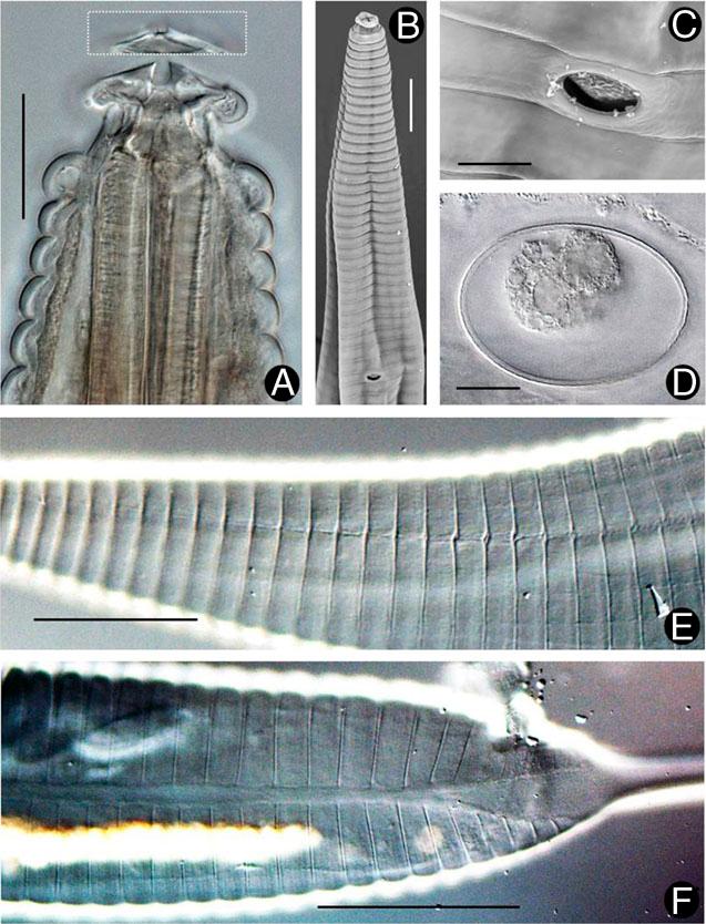 Stauratostoma shelleyi n. gen., n. sp. A, Head end, lateral view; inset shows accessory spine near amphid aperture. B, Scanning electron microscope of anterior region showing large S–E pore. C, S–E pore with operculum. D, Typical egg, with slightly roughened outer layer. E, Lateral field, esophageal region. F, Lateral field, posterior region. Figures 3E, F are phase-contrast images. Scales: A, D = 20 μm; B, F = 50 μm; C = 10 μm; E = 100 μm.