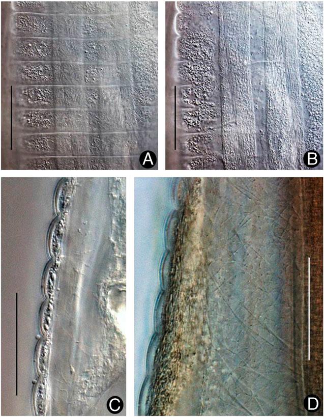 Stauratostoma shelleyi n. gen., n. sp. A, B Pebble-like longitudinal subcuticular bands alternating with muscle bands; figures are of same area but imaged at different focus depths. C Annules in profile with pebbly subcuticle. D Annules in profile at a muscle zone, and extensive lattice of fibers in pseudocoel. Scales = 50 μm.