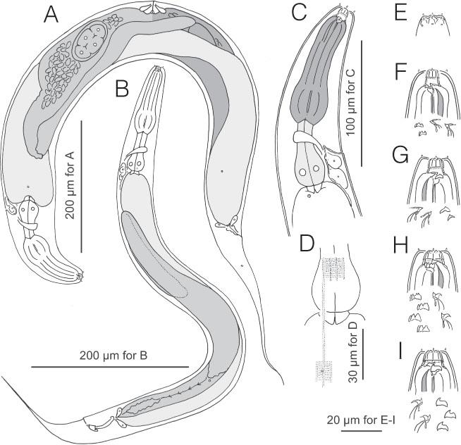 Pristionchus sikae sp. n. Drawings are of live specimens (non-types) from temporary mounts. A, Stenostomatous female in right lateral view. B, Stenostomatous male in left lateral view. C, Anterior region of stenostomatous female in left lateral view. D, Body surface showing longitudial striations, annulations and relative position of deirid and lateral glands. E, Anterior end of stenostomatous male in left lateral view. F, Stomatal region of stenostomatous male in left lateral view; below (from left to right) are left subventral ridge and dorsal tooth. G, Stomatal region of stenostomatous female in right lateral view; below are dorsal tooth and right subventral denticle. H, Stomatal region of eurystomatous female in left lateral view; below are left subventral ridge and dorsal tooth. I, Stomatal region of eurystomatous female in right lateral view; below are dorsal tooth and right subventral tooth.