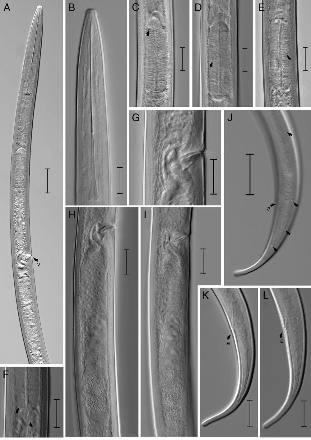 Light photomicrographs of Xiphinema parachamberi n. sp. female. A: Anterior region, arrow showing position of vulva (v); B: Lip region; C-E: Esophageal bulb (arrows showing different position of gland nuclei); F: Esophago-intestinal junction arrows pointing the base of pharyngeal bulb and cardia. G: Vulval region; H, I: Gonad; J: Female tail (arrows showing position of (a) anus and caudal pores); K, L: Female tail (arrows showing position of (a) anus) (Scale bars: A, L = 10 μm).