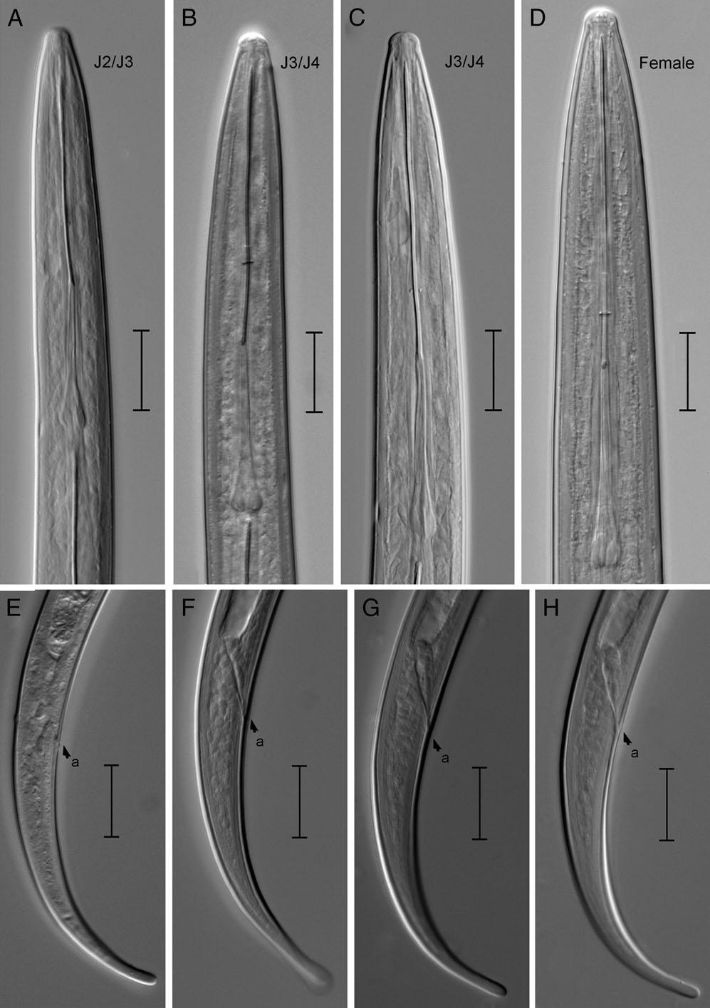 Light photomicrographs of Xiphinema parachamberi n. sp. juveniles and female. A–D: Anterior regions of J2/J3, J3/J4 and female; E–H: Tail regions of J2/J3, J3/J4 and female (arrows showing position of anus (a)) (Scale bars: A–L = 10 μm).