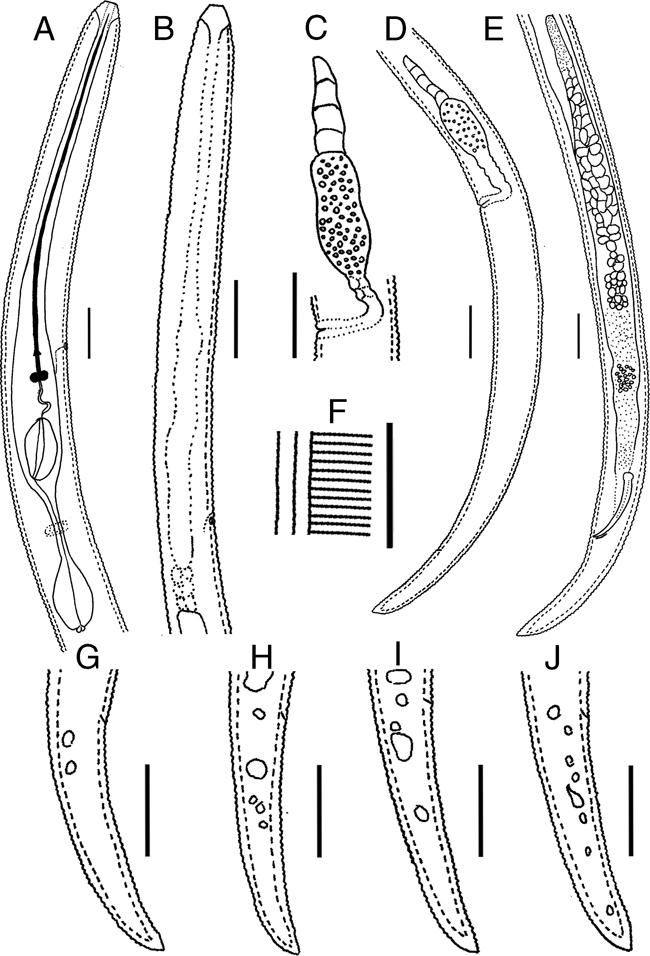 Line drawings of Gracilacus paralatescens n. sp. A: Female pharynx; B: Male pharynx; C: Vulval region and reproductive branch; D: Female posterior body; E: Male posterior body; F: Lateral lines; G-J: Female tails (Scale bars =10 μm).