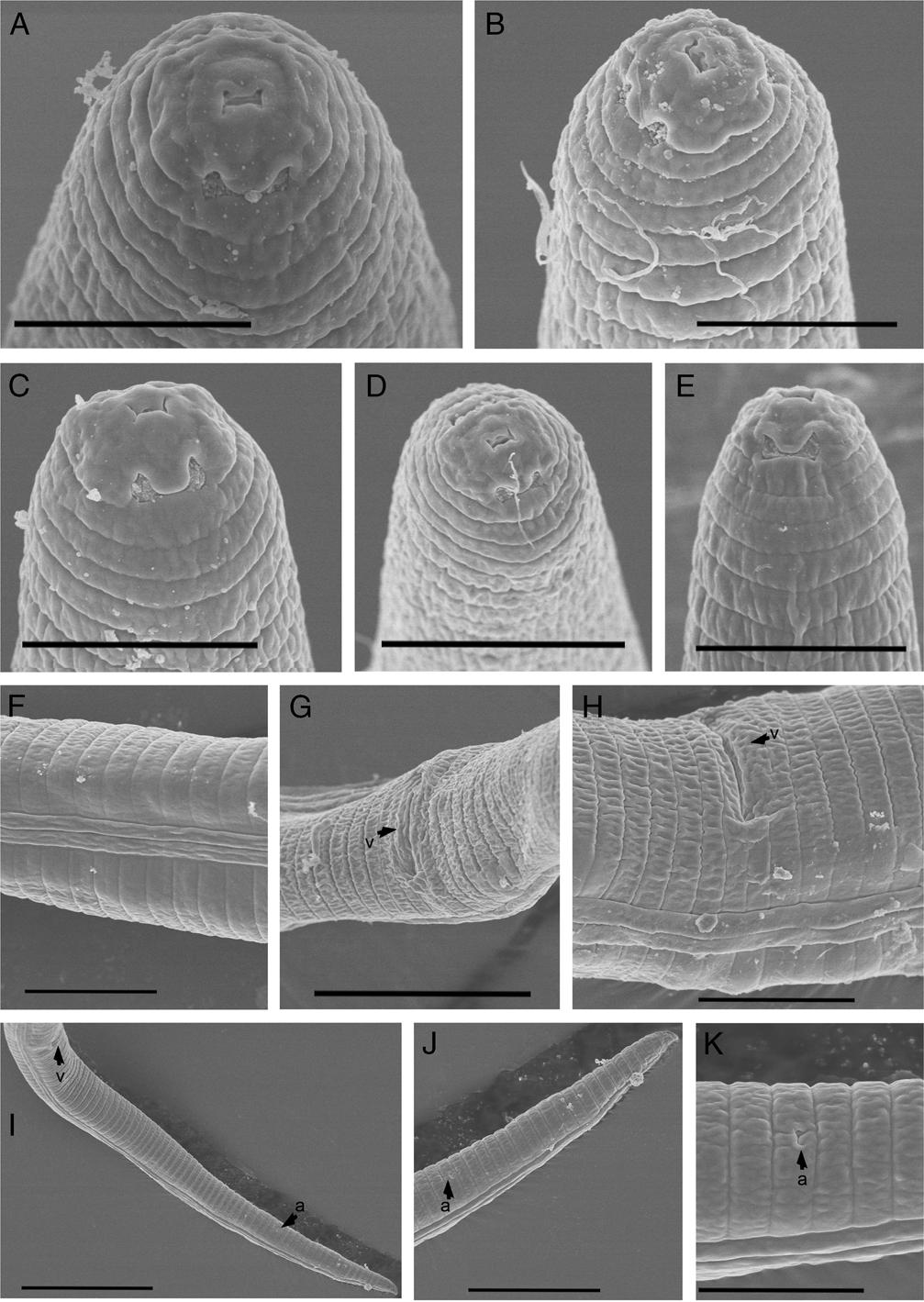 Scanning electron microscopy of Gracilacus paralatescens n. sp. A-E: Lip region; F: Lateral lines; G, H: Vulval regions; I: Posterior region arrows showing position of vulva (v) and anus (a); J: Tail region arrow showing position of anus; K: Anal region (Scale bars, A-C = 3 μm; E, K = 4 μm; D, H = 5 μm; J, G = 10 μm; I =20 μm).