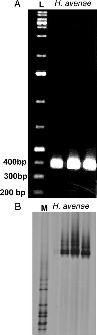 GC-clamped PCR products amplified from the genomic DNA of three single cysts of Heterodera avenae. (A) 1.5% agarose gel electrophoresis; L: 1 kb ladder. (B) DGGE profiles of vap1 gene fragments of Heterodera avenae from three single cysts compared to the distinct gene fragments of Heterodera schachtii in the marker (L).