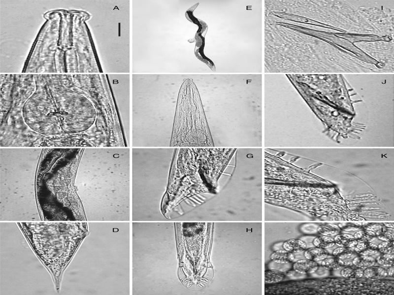 Pelodera strongyloides light photomicrographs – Female. A: Anterior end, lateral; B: Pharyngeal basal bulb; C: Vulval region, in lateral view; D: Tail region; E: Entire female; F: Pharyngeal region; Male. G: Tail, in lateral view; H: Tail, in ventral view; I: Excised spicules with gubernaculum; J, K: Tail, in lateroventral view; L: Cells of the spermatheca. Scales (in μm): A, B, I, K, L = 16; C, F, H = 50; E = 250; D, G, J = 22.5.