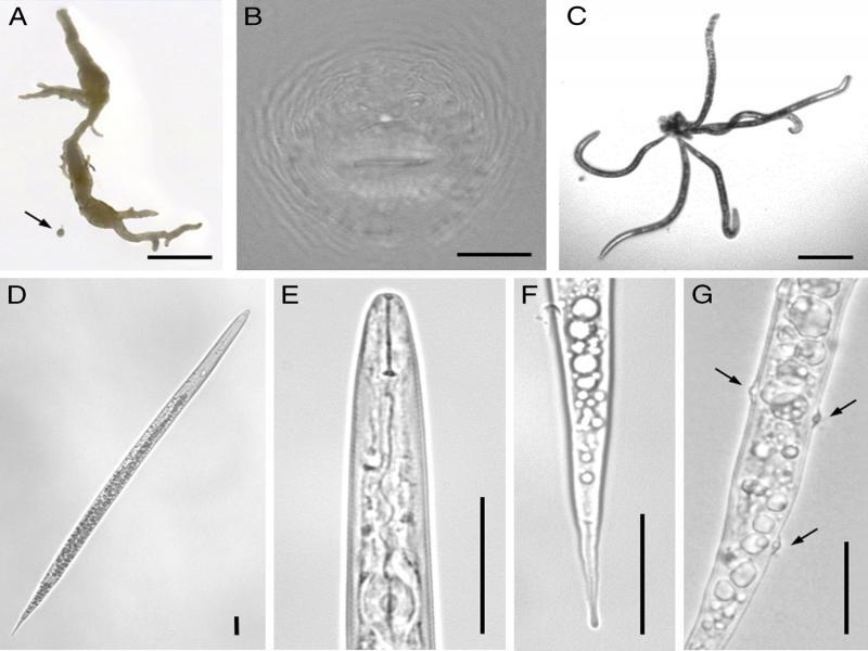 Root-knot nematodes (Meloidogyne naasi Franklin, 1965) extracted from soil and root samples collected from a football field in Portugal. A: turfgrass root showing galling by root-knot nematodes and excised M. naasi female (arrow); B: perineal pattern; C-G: second-stage juveniles: C: worm-star aggregation; D: whole body; E: pharyngeal region; F: tail; G: Pasteuria penetrans (ex Thorne, 1940) Sayre and Starr, 1985 endospores (arrows) attached to cuticle. Bars = 2000 µm (A); 125 µm (C); 25 µm (B, D-G).