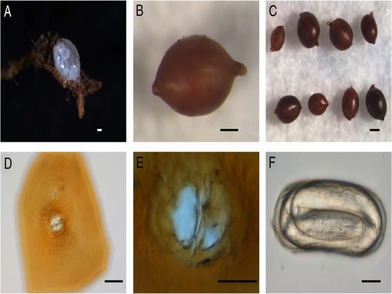 Light micrographs of H. microulae sp. n. A: immature female on the root; B: Cyst; C: Cysts; D-E: Fenestration in vulval cone; F: Egg (scale bar: A, D = 50 µm; B = 100 µm; C = 200 µm; E, F = 20 µm).