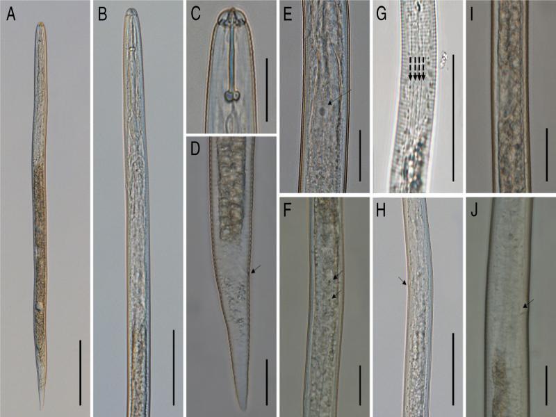 Light micrographs of second-stage juvenile of H. microulae sp. n. A: Entire body; B: Anterior region of; C: Head region; D: Tail region; E: Posterior pharyngeal region arrow showing the position of dorsal gland nucleus; F: Posterior pharyngeal region arrow showing the position of subventral gland nuclei; G: Lateral field; H: Hemizonid; I: Genital primordium; J: Excretory pore (scale bar: A = 100 μm, B, H, G = 50 μm, C, D, E, F, I, J = 20 μm).