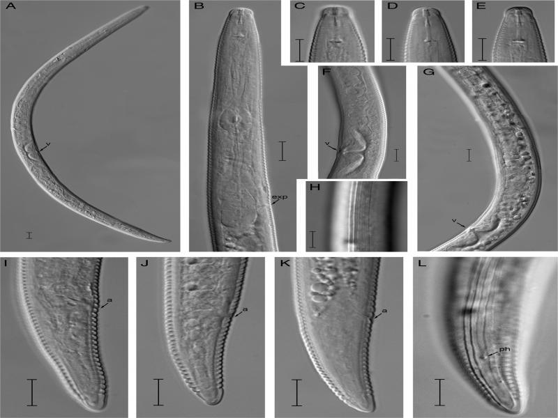 Quinisulcius curvus Female. (A) Entire female; (B) Pharyngeal region; (C-E) Lip region; (F, G) Vulval region; (H) Lateral lines; (I-L) Tail regions. Scale bars (A = 10 μm; B-L = 10 μm) Abbreviation: a=anus; exp = excretory pore; ph = phasmid; v = vulva.