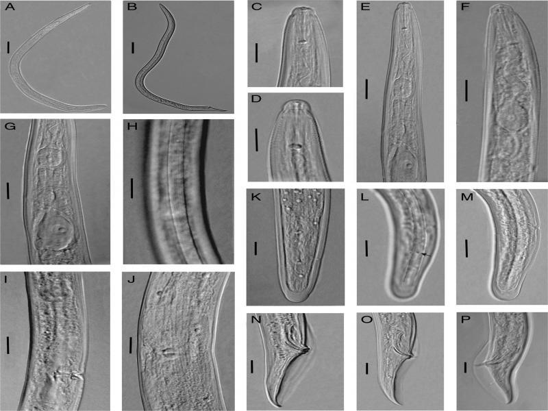 Light photomicrographs of Bitylenchus hispaniensis from Iran. A, C-M: Female. A: Entire body; C, D: Anterior body region; E-G: Pharyngeal region; H: Lateral field at mid-body; I, J: Vulval region; K-M: Posterior body region (the arrow indicates the phasmid); B, N-P: Male. B: Entire body; N-P: Posterior body region. (Scale bars: A, B = 50 μm; C-P = 10 μm).