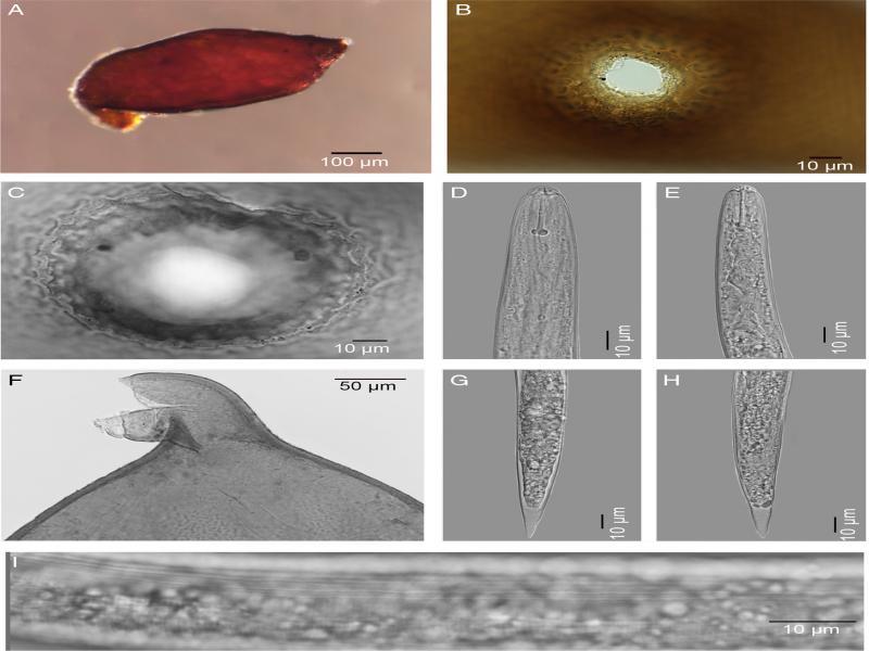 Photomicrographs of cysts, vulva cones and second-stage juveniles (J2) of Cactodera torreyanae. A: Entire cyst; B-C: Vulva cones; D-E: Anterior end of J2s; F: Cyst anterior end (arrow showing anterior end of J2 with stylet sticking out); G-H: Tails of J2s; I: Lateral field with 4 incisures for J2.