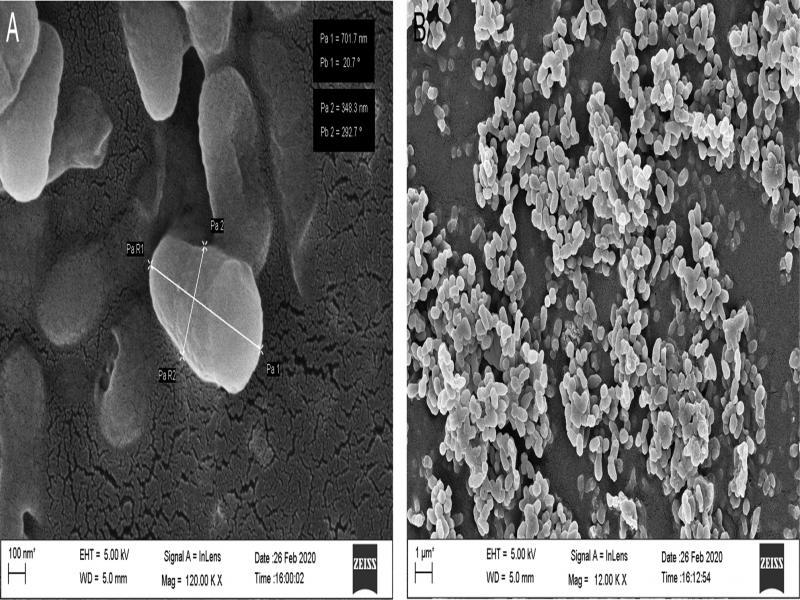 Phylogenetic tree showing the genetic relationship of the BETL4 isolate to other isolates by using maximum likelihood method.
