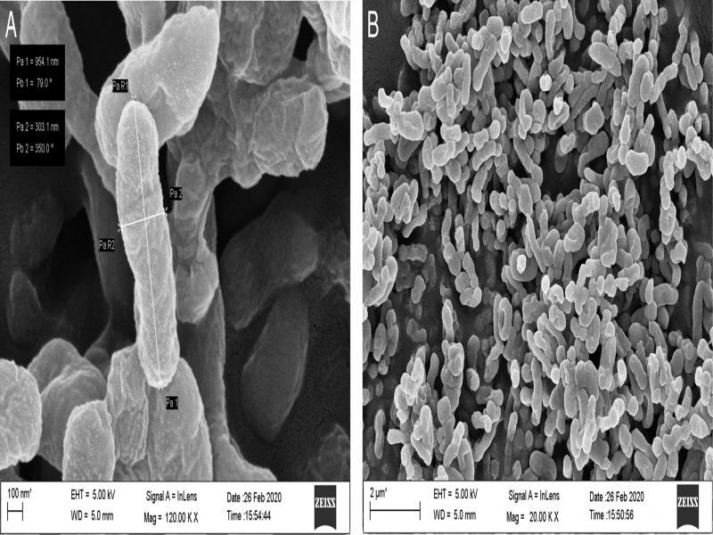 Phylogenetic tree showing the genetic relationship of the BETS2 isolate to other isolates by using maximum likelihood method.
