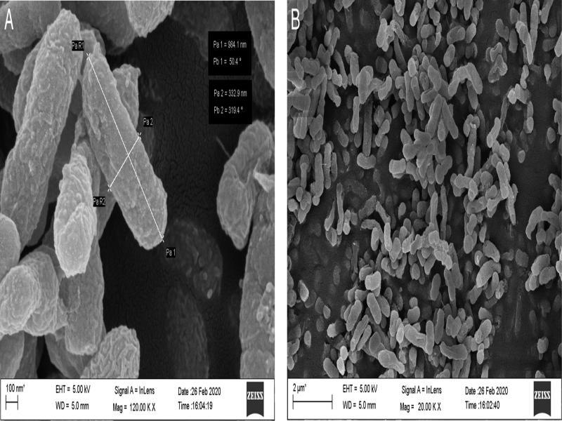 Phylogenetic tree showing the genetic relationship of the BETL6 isolate to other isolates by using maximum likelihood method.
