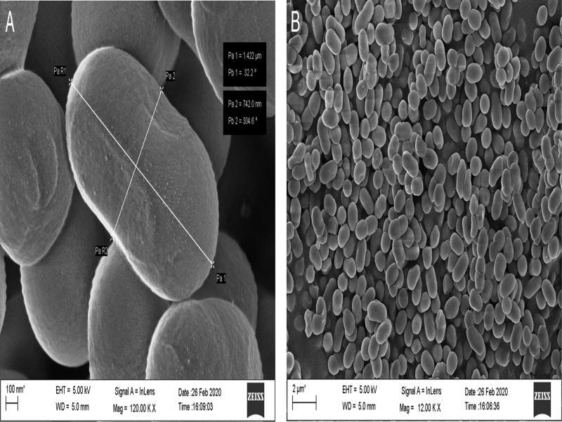 Effect of culture filtrates of isolated bacterial endophytes on juvenile mortality of Meloidogyne incognita at 10% (S/10) concentration at different exposure time.