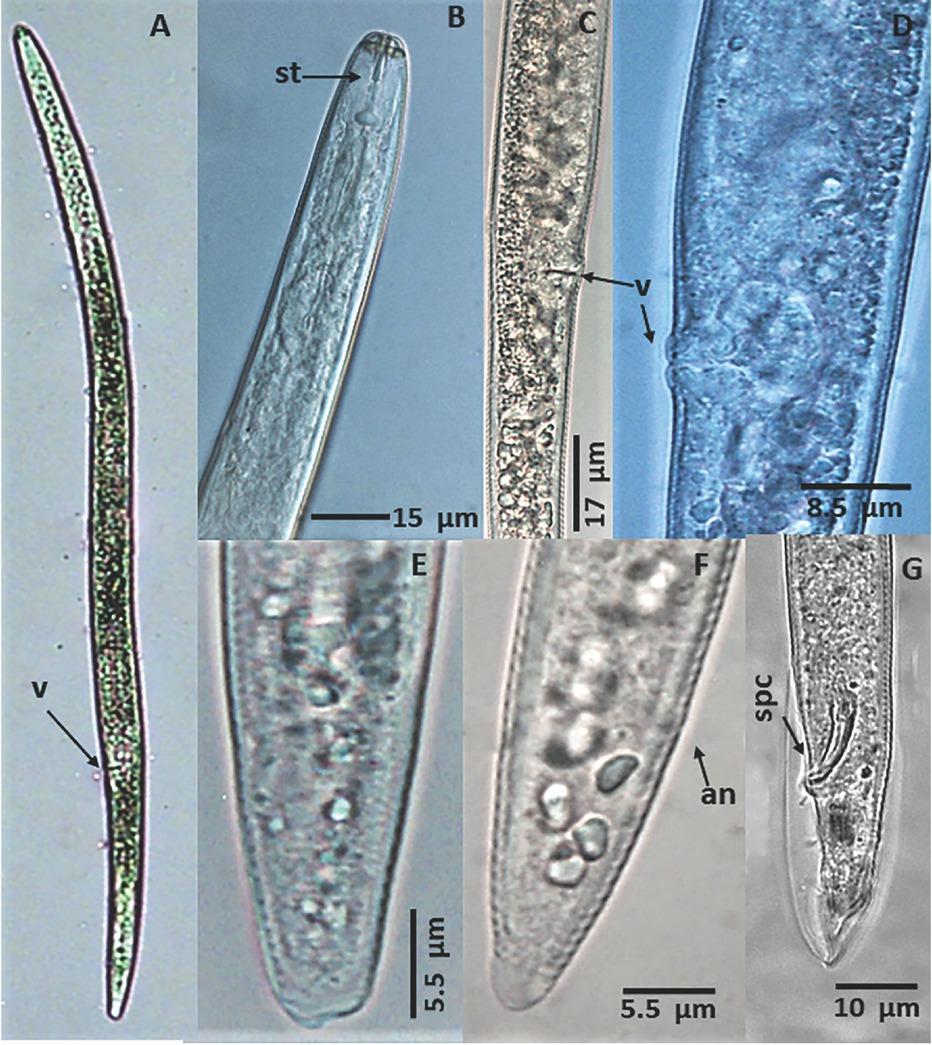 Pratylenchus araucensis. (A–F): Female. (A). Body of a female, (B). Anterior body region, (C and D). Vulval region. (E and F). Posterior region. (G). Posterior region of the body of a male. St = Stylet, v = Vulva, an = Anus, spc = Spicule.