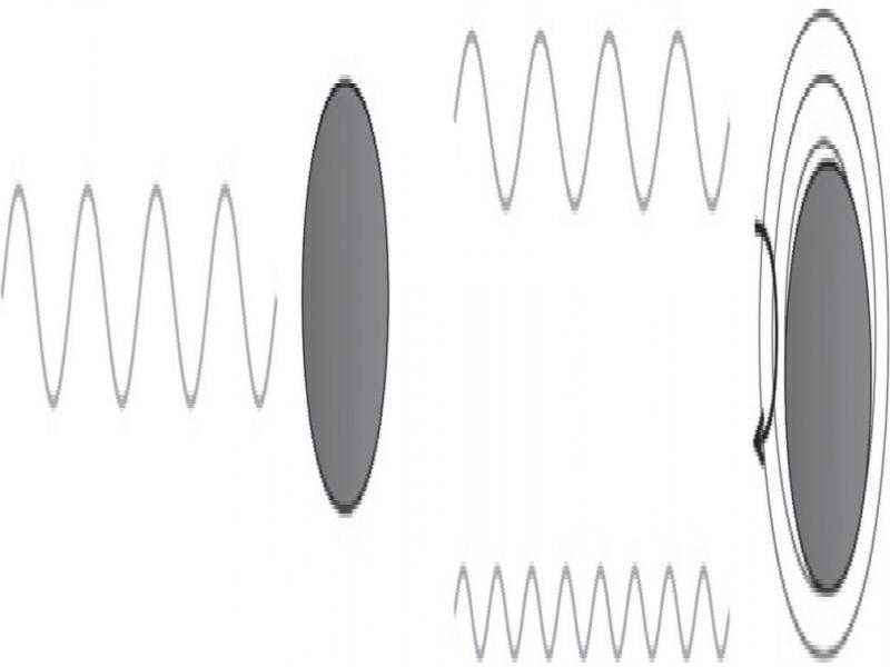 Intermediate MI of 0.4–0.8; microsphere resonance