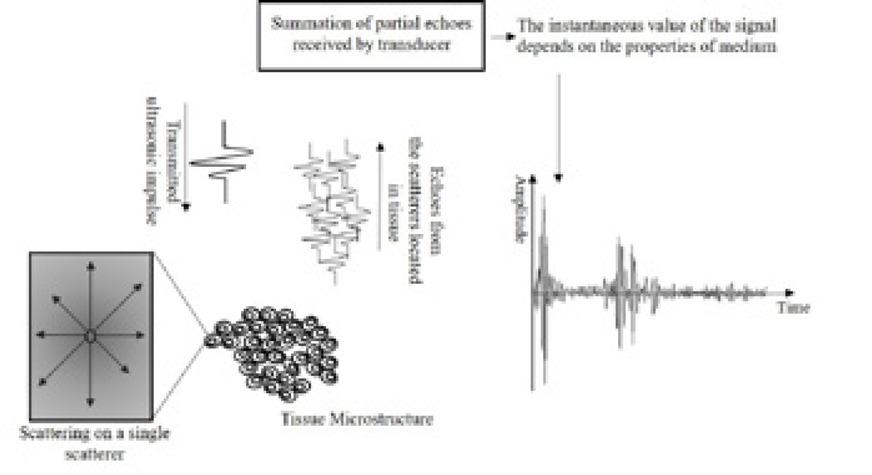 Diagram of ultrasonic RF signal formation as a result of scattering on inhomogeneities present in the tissue