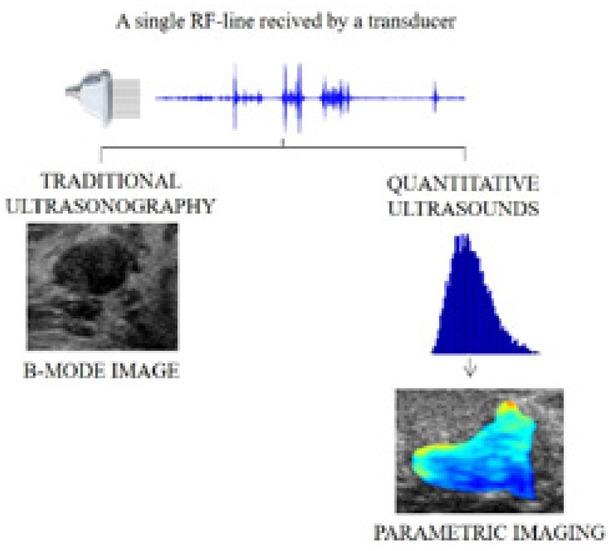 Principle of operation of traditional ultrasonography (B-mode imaging) and quantitative ultrasound. In the case of a parametric map (generated based on the analyzed biomarker value – the effective number of diffusers), red denotes high values of the parameter (indicating a large number of identical small scatter structures), while blue represents low values (indicating a small number of large scatterers, e.g., clusters of cancer cells)