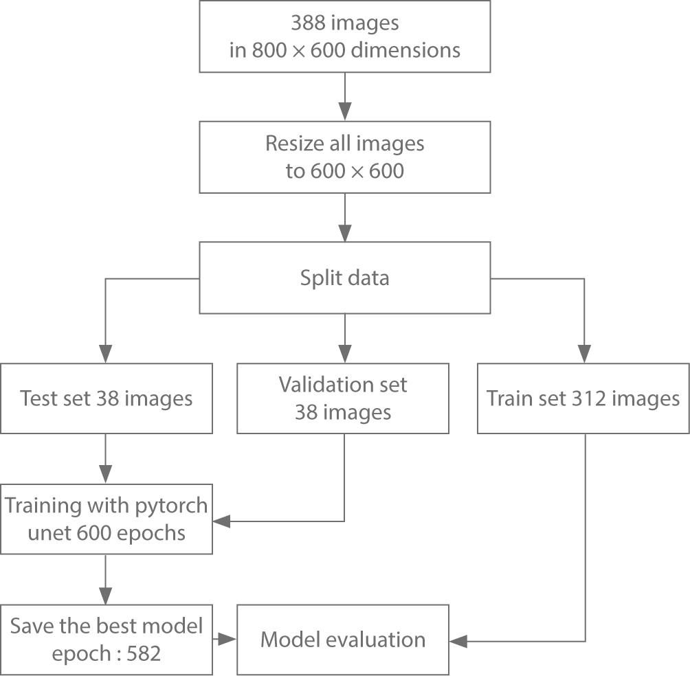 AI Model (CranioCatch, Eskisehir-Turkey) Pipeline for Masseter Muscle Segmentation in USG Images