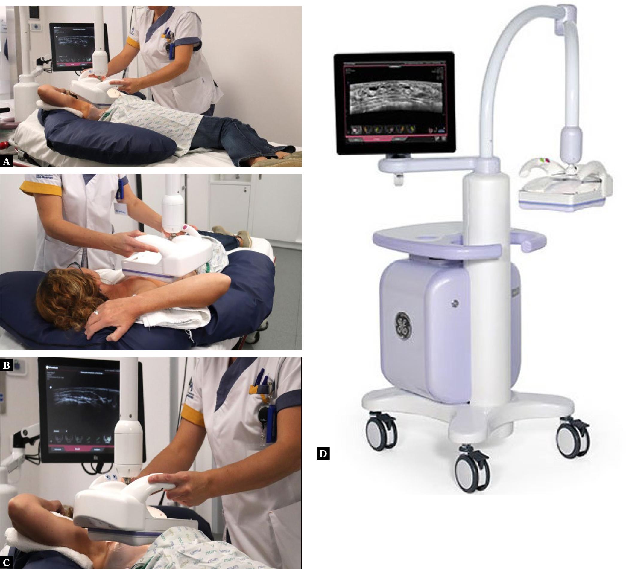 Examination position. Supine position with rising arm above the head to acquire the ABUS views covering the breast while using a pillow under the patient’s shoulder to get an adequate compression (A, B, C). ABUS equipment used in our department – Invenia™ (GE Healthcare, USA, used with permission) (D)