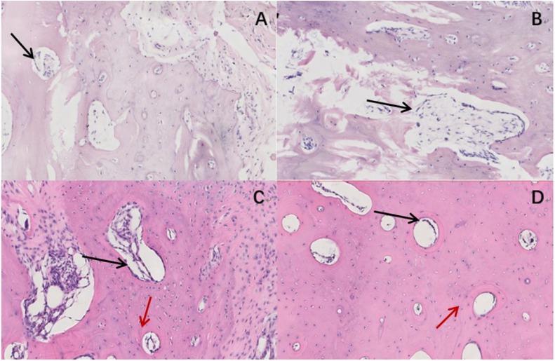 Histopathological observation of free bone in groups T and C at 6 and 12 weeks after reimplantation. A and C are the histological observation at weeks 6 and 12 after reimplantation surgery for group T; B and D are the equivalent histological observation for group C. A – visible bone resorption, trabecular bone, and a small number of osteoblasts (black arrow) (HE, 200×); B – visible small trabecular bone, fibrous tissue oedema at the junction (black arrow) (HE, 200×); C – a large number of osteoblasts are present (black arrow) The bone plate is arranged regularly (red arrow) (HE, 200×); D – a large amount of new bone formation (black arrow) is visible, and the bone plate is arranged regularly (red arrow) (HE, 200×)