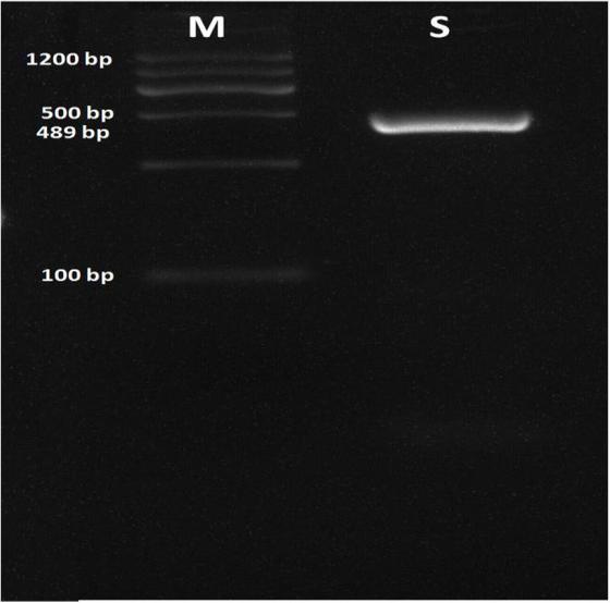 PCR amplification of 12S rRNA gene. The12S rRNA gene (489 bp) of C. tenuicollis was amplified and resolved on 1.5% agarose gel. Lane M –marker (100-bp ladder DNA); lane S – positive C. tenuicollis isolate