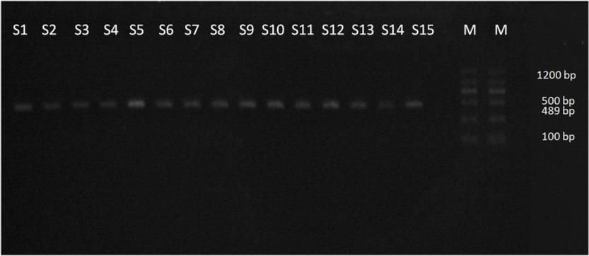 DNA purification of 12S rRNA gene. PCR products of 12S rRNA gene were recovered and electrophoresed on 1.5% agarose gel. Lane M – marker (100-bp ladder DNA); lanes S1-S15 – positive C. tenuicollis isolates