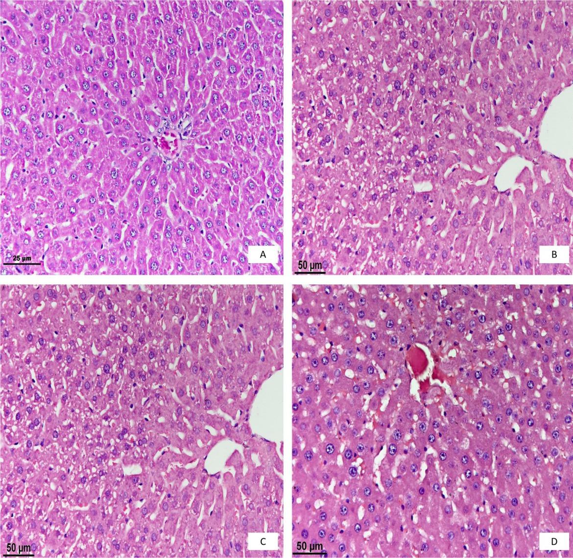 Histopathological examination of the liver. A – the control group; B – the first day; C – the second day; D – the third day