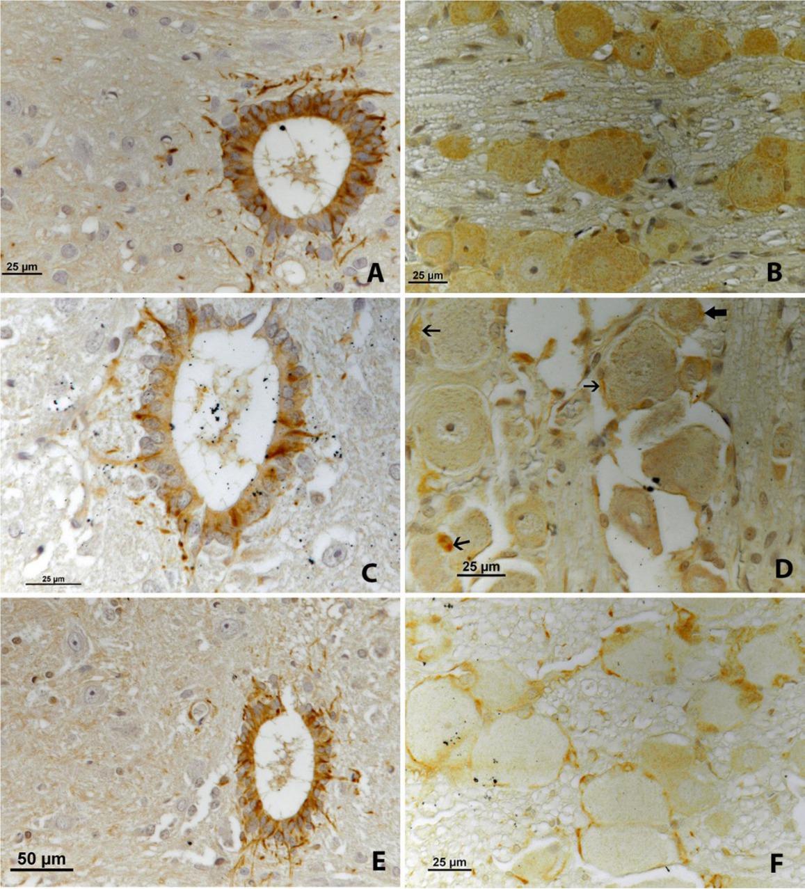 iNOS immunoreactivity. A – the first day, in the spinal cord; B – the first day, in the nodose ganglion; C – the second day, in the spinal cord; D – the second day, in the nodose ganglion; E – the third day, in the spinal cord; F – the third day, in the nodose ganglion