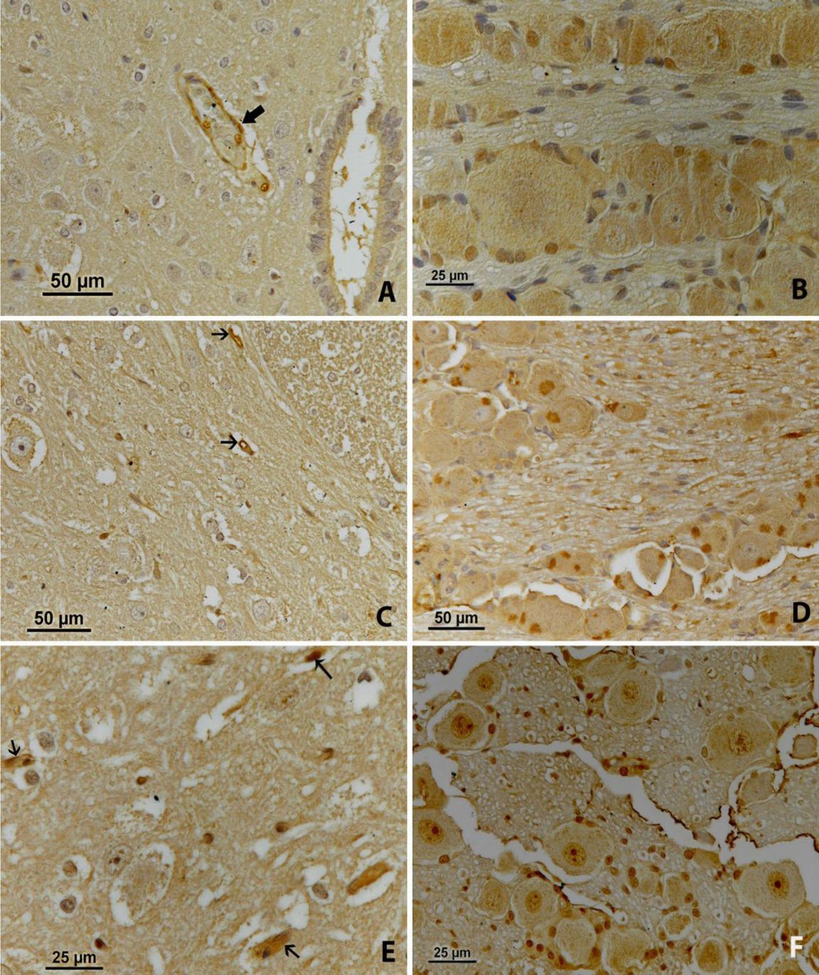 eNOS immunoreactivity. A – the first day, in the spinal cord; B – the first day, in the nodose ganglion; C – the second day, in the spinal cord; D – the second day, in the nodose ganglion; E – the third day, in the spinal cord; F – the third day, in the nodose ganglion