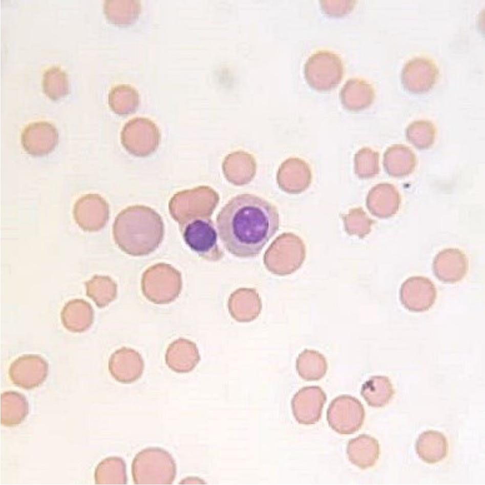 Representative cytological image of a bone marrow smear stained with the May–Grünwald–Giemsa method showing basophilic and normochromatic erythroblasts in the control group on day 0; 1,000×