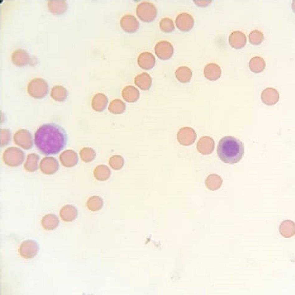 Representative cytological image of a bone marrow smear stained with the May–Grünwald–Giemsa method showing basophilic erythroblasts in the LD group on day 28; 1,000×