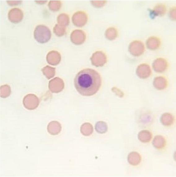 Representative cytological image of a bone marrow smear stained with the May–Grünwald–Giemsa method showing polychromatic erythroblasts in the LD group on day 28; 1,000×