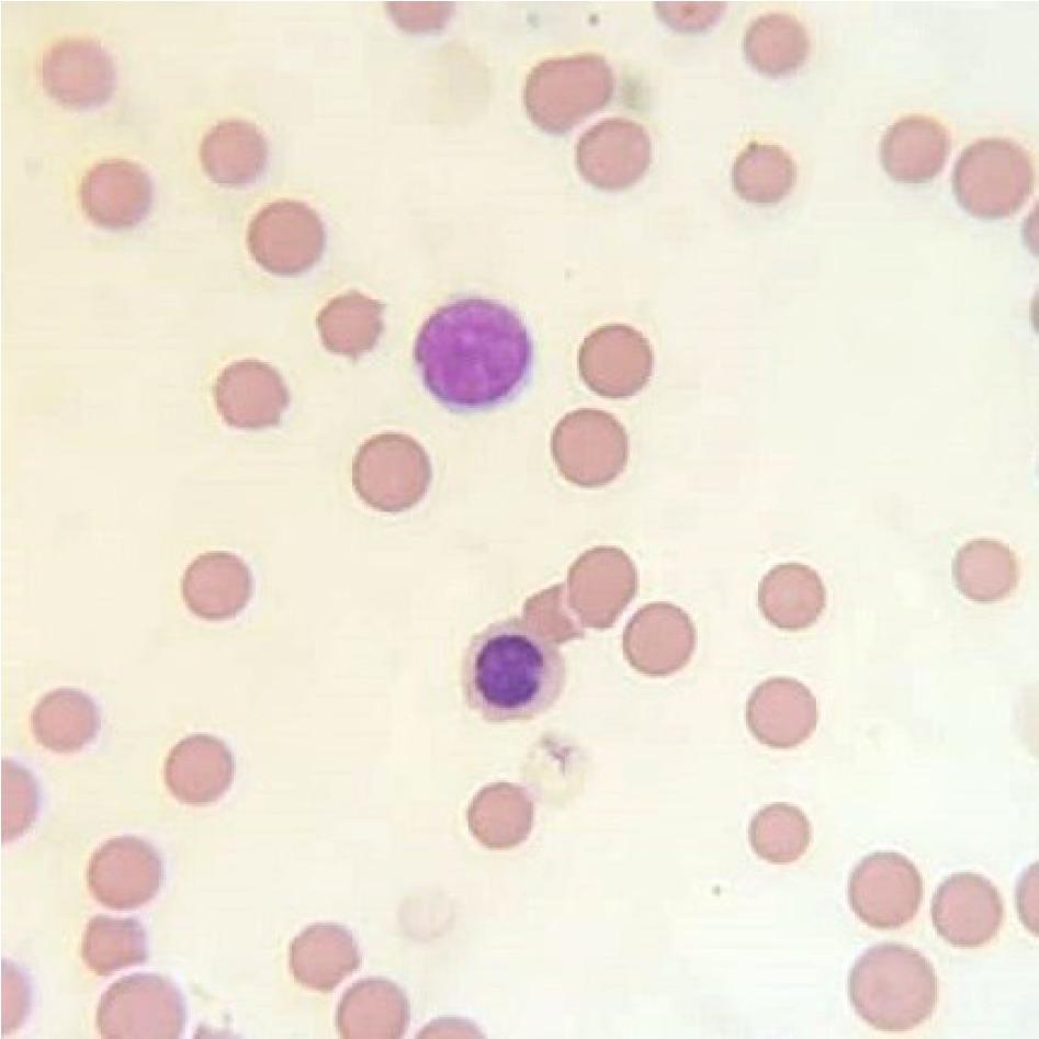 Representative cytological image of a bone marrow smear stained with the May–Grünwald–Giemsa method showing polychromatic erythroblasts in the HD group on day 28; 1,000×